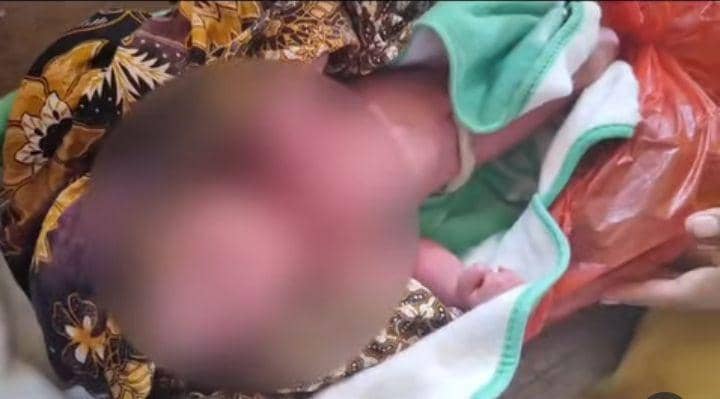 Bayi Laki-laki Ditemukan Warga Dekat Pembuangan Sampah Gunung Anyar