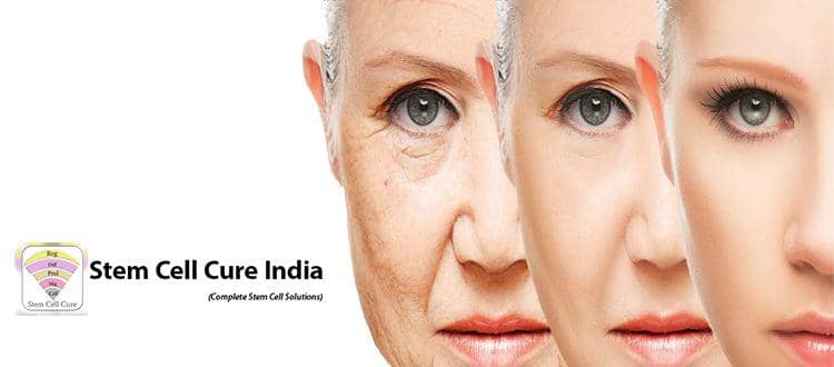 (Ilustrasi Stem cell facelift) stemcellcure.in