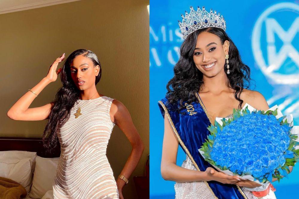 7 Potret Hasset Dereje Miss World Ethiopia 2025, Sweet Abis!