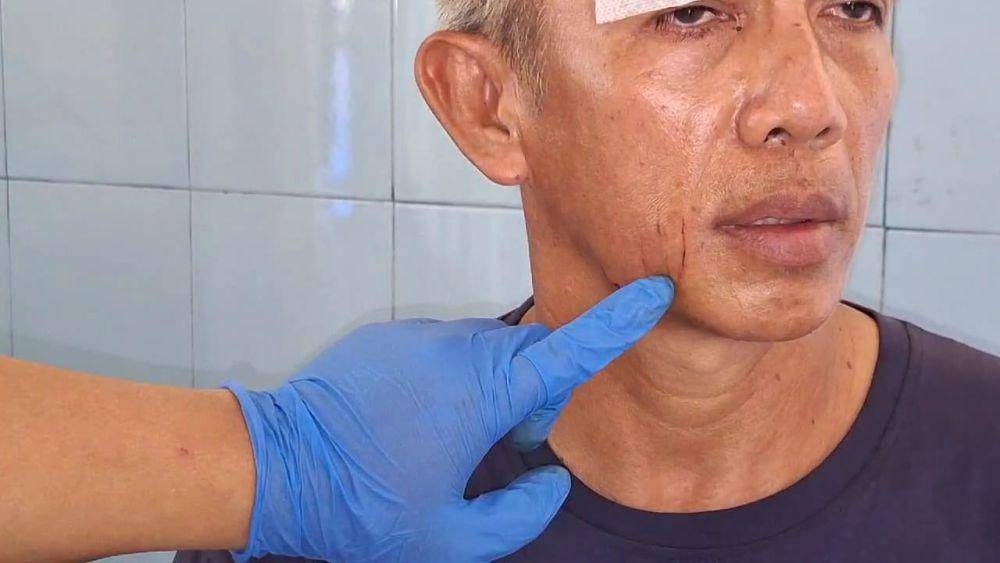 Maman Sumantri sopir truk semen saat dirawat di Puskesmas Kartoharjo Magetan. IDN Times/ Riyanto.