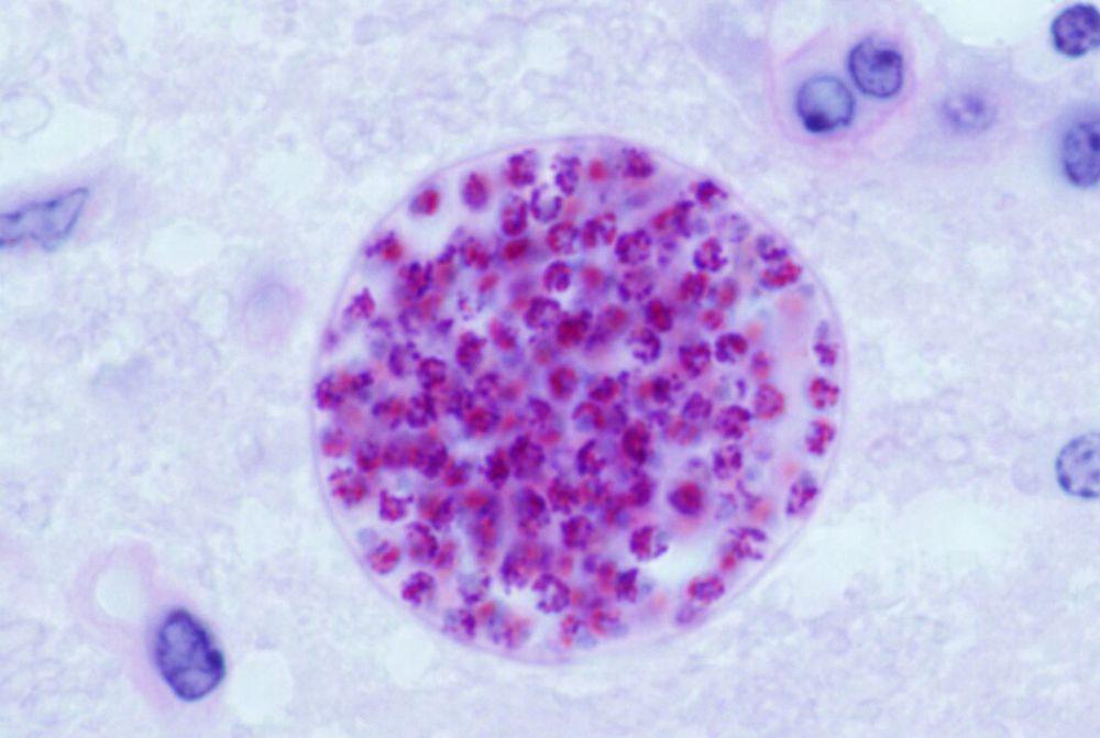 5 Fakta Menarik Virus Toxoplasma gondii, Menjadikan Inangnya Agresif