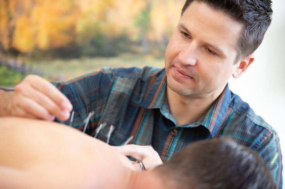 Ilustrasi terapi dry needling dengan jarum tipis yang ditusukkan pada titik tertentu di tubuh pasien.