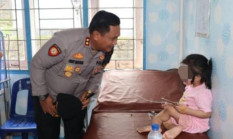 Bocah di Nisel Dianiaya hingga Cacat, Ini Kata Kemen PPPA