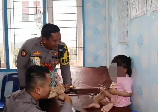 Anak korban kekerasan di Nias Selatan, Sumatra Utara alami cacat di kaki (Dok/Gerindra Sumut)