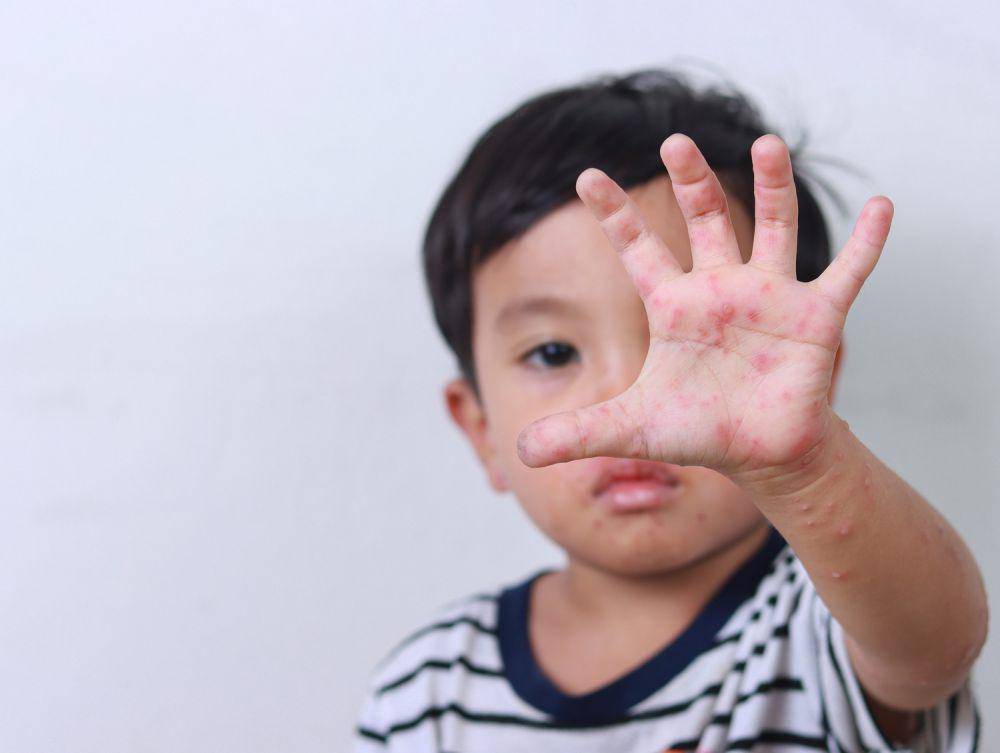 ilustrasi foto seorang anak laki-laki sedang terkena alergi. (freepik.com/EyeEm)