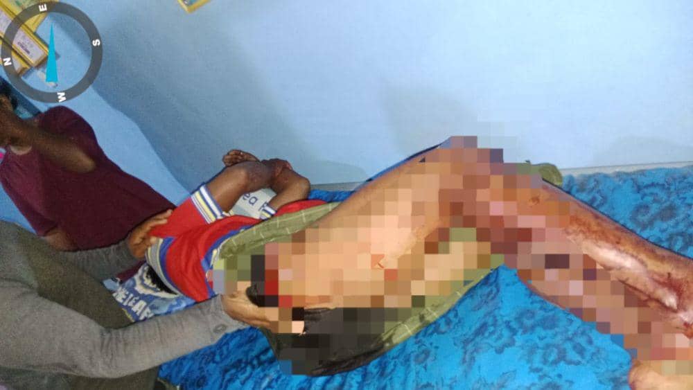 Korban perampokan Watiman saat dievakuasi warga ke puskesmas setempat (Dok: Polsek Muara Telang)