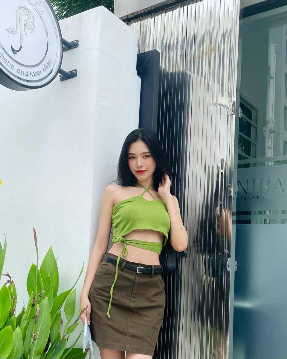 Potret Miss Supranational Myanmar 2025, Lin Cherry Moe (instagram.com/cherry_moe_01)