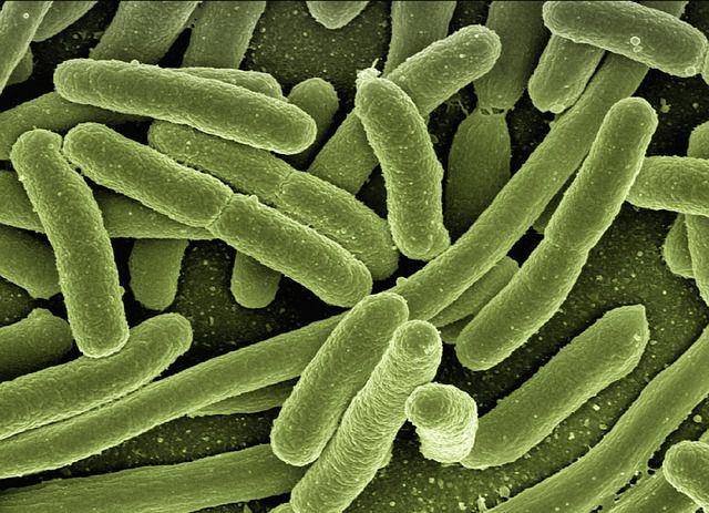 Bakteri Escherichia coli (pixabay.com/geralt)