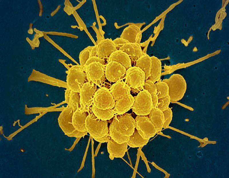 ilustrasi bakteri Neisseria gonorrhoeae, penyebab gonore (flickr.com/NIAID)