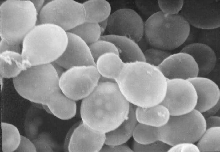 Malassezia furfur. (commons.wikimedia.org/Robert Simmons/Janice Carr Photo Credit: CDC/Janice Carr)