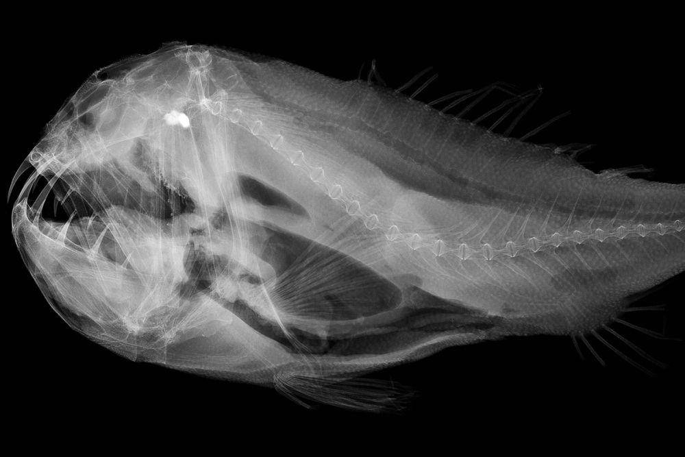 sinar-x ikan taring (commons.wikimedia.org/Sandra Raredon/Smithsonian Institution)