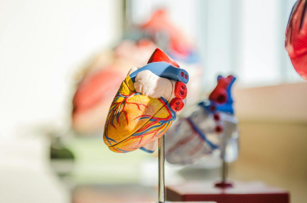 Stenosis Katup Mitral: Penyebab, Gejala, Komplikasi, Pengobatan