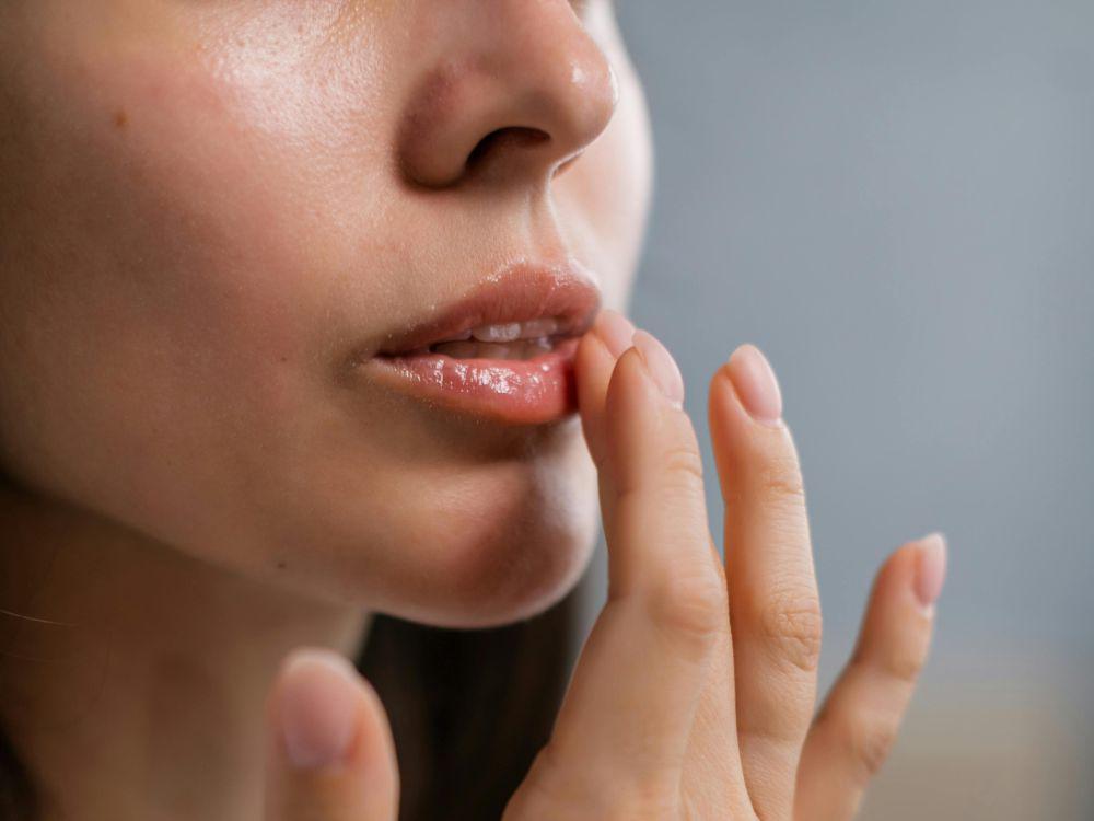 5 Cara Mencegah Bibir Kering Selama Puasa Ramadan agar Tetap Fresh