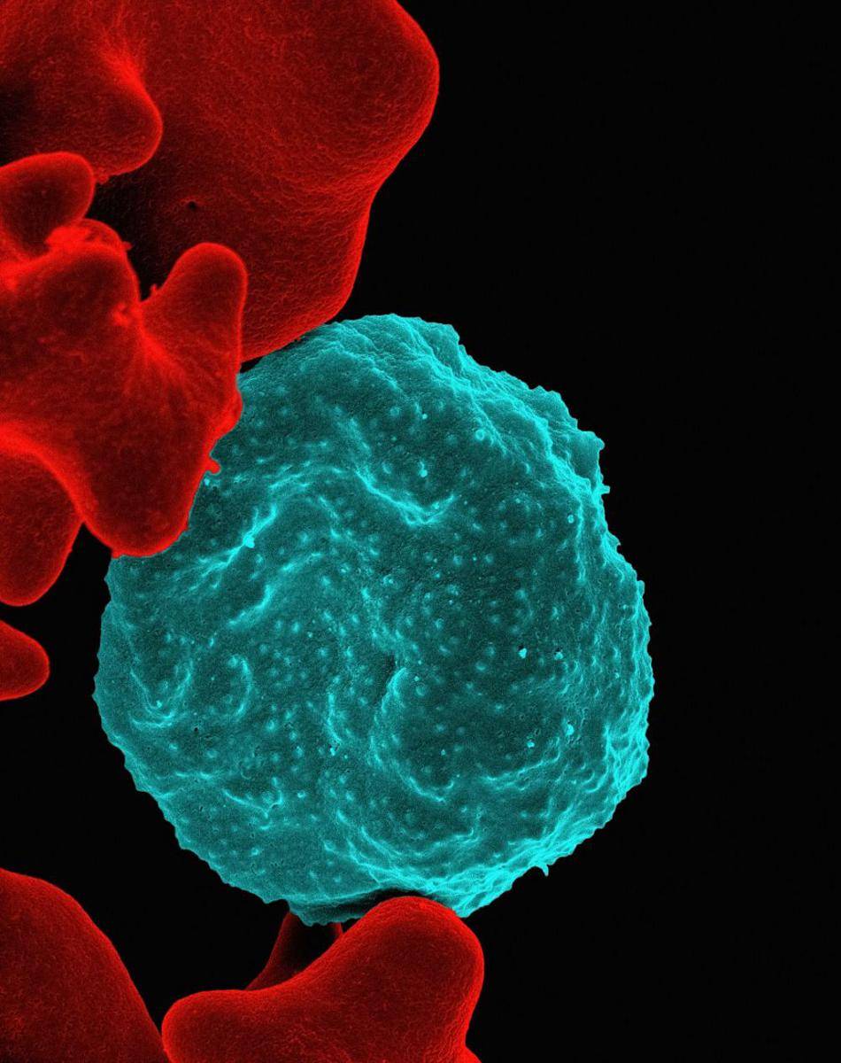 Ilustrasi parasit plasmodium. Malaria disebabkan oleh gigitan nyamuk Anopheles yang terinfeksi parasit plasmodium. (unsplash.com/National Institute of Allergy and Infectious Diseases)