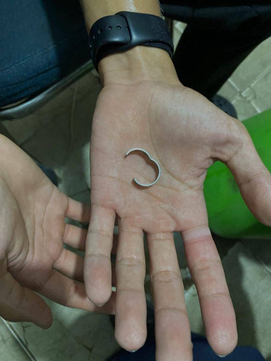 Cincin yang berhasil dilepas oleh Damkarmat Bandar Lampung. (IDN Times/Damkarmat Bandar Lampung)