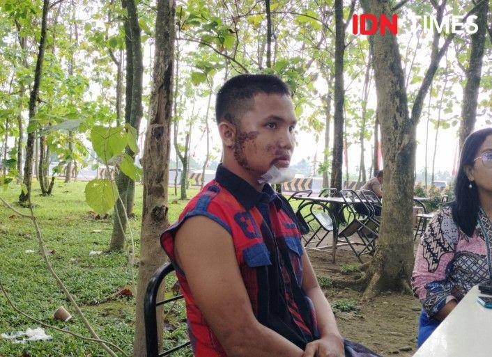 Roberto jadi korban pembegalan saat pergi ikut tes kesehatan Bintara (IDN Times/Eko Agus Herianto)