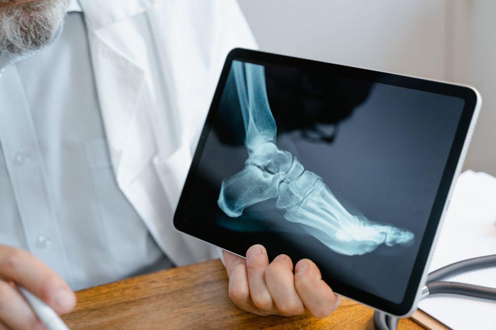 5 Hubungan Antara Estrogen dengan Osteoporosis, Risiko dan Pencegahan
