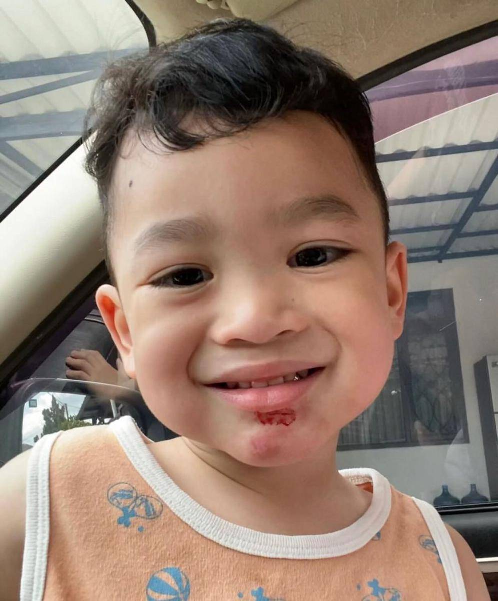 Anak Gilang Dirga dioperasi (Instagram.com/adieztyfersa)