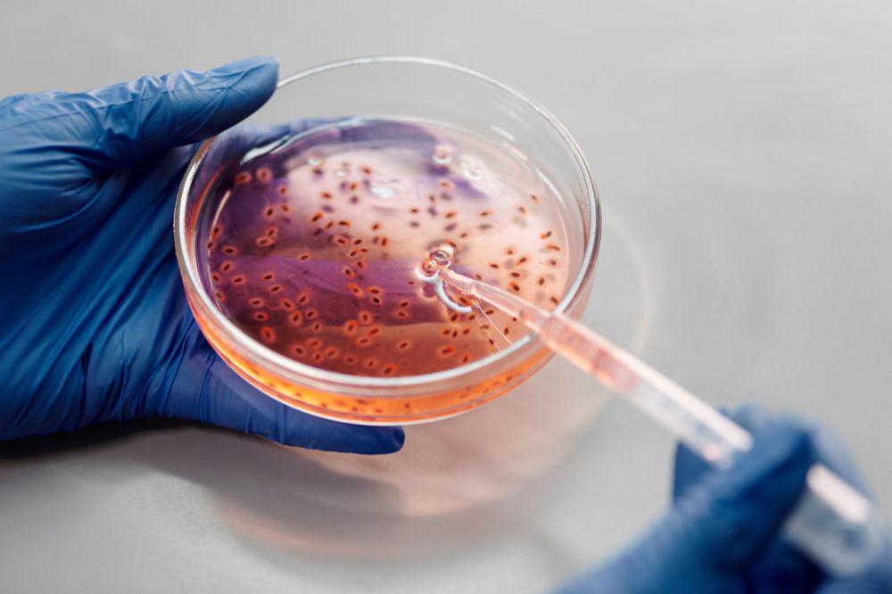 Penyakit karena Bakteri Salmonella dan E. Coli, Kenali Gejalanya