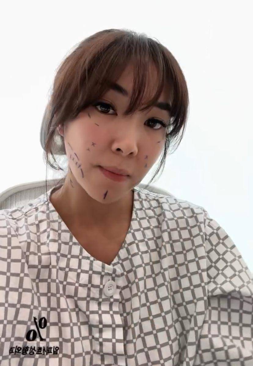 potret Gisella Anastasia operasi plastik di Korea (Instagram.com/ gisel_la)