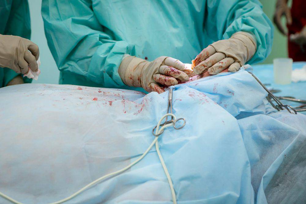 foto seseorang yang sedang dioperasi oleh tim dokter di ruang operasi (unsplash.com/olga_kononenko)