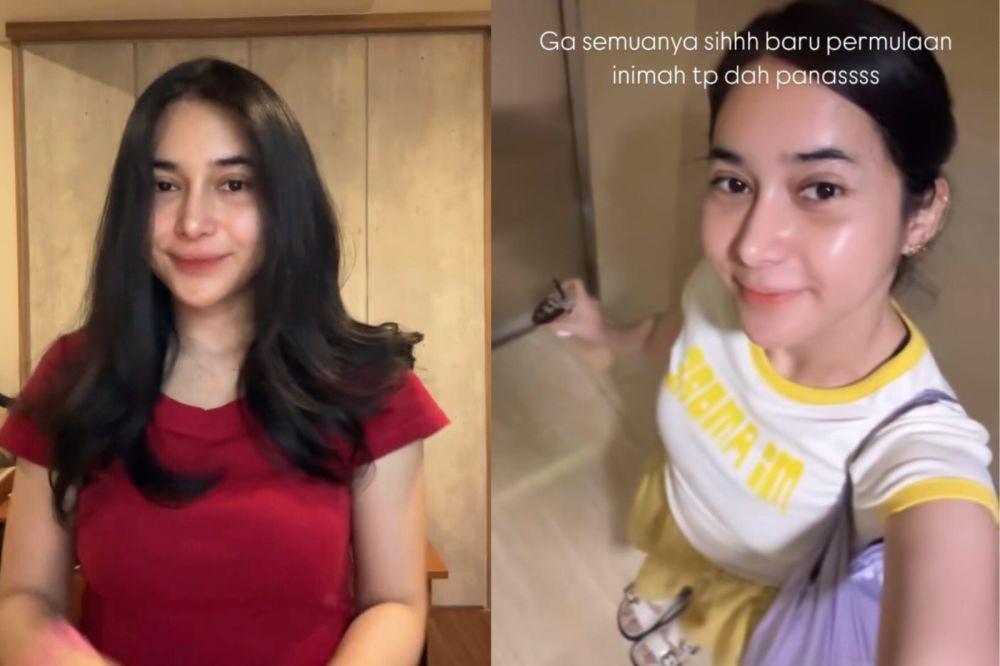 Potret Dilan Janiyar Usai Operasi Plastik di Korea, Lama Tak Terlihat