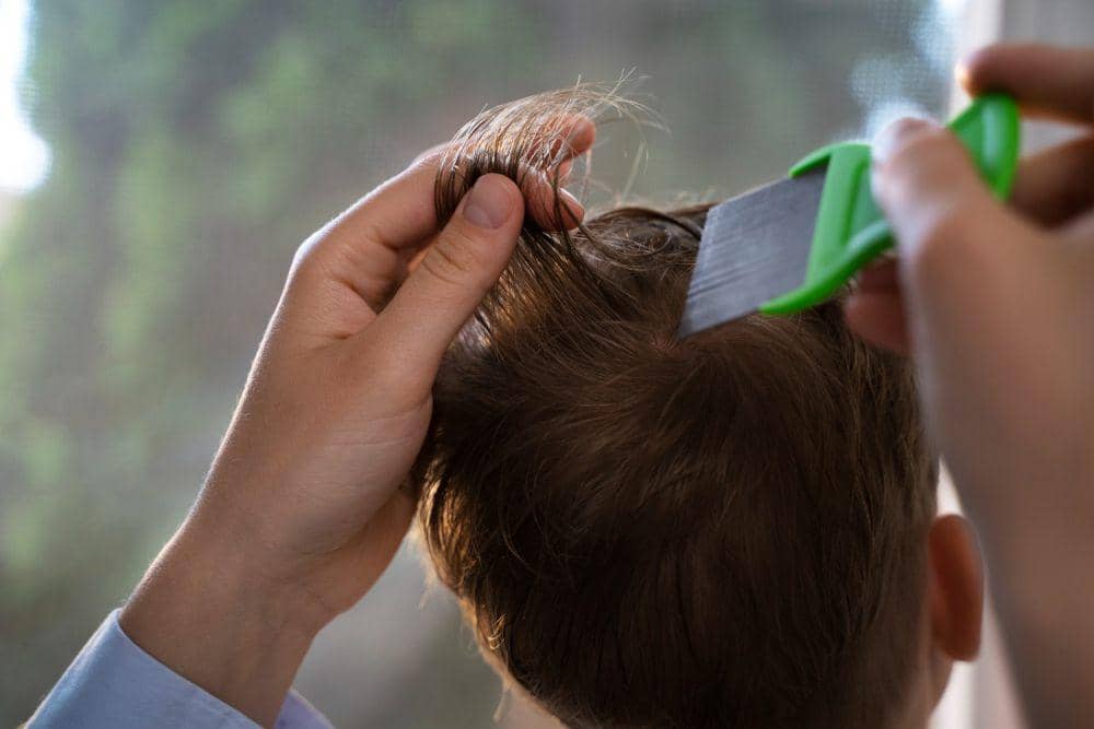 Ilustrasi tangan menyisir rambut anak dengan sisir serit untuk mengatasi kutu rambut yang terlihat di kulit kepala.