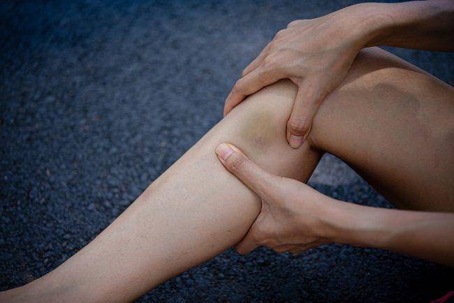 ilustrasi Memar (pexels.com/polina)