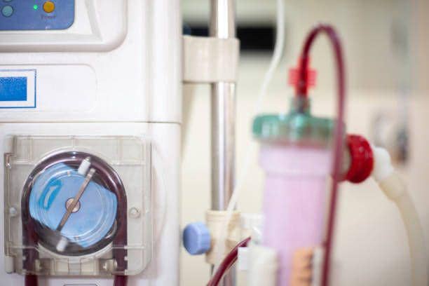 ilustrasi proses cuci darah(istockphoto.com/Paul Zilvanus Lonan)