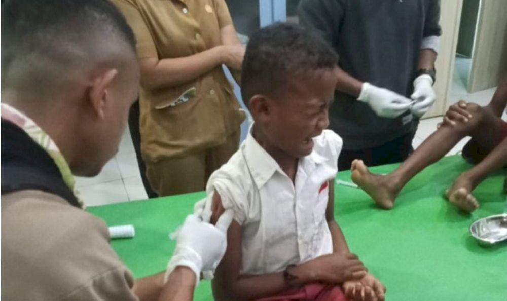 Wabah Rabies di NTT Tewaskan 91 Orang, Menyebar hingga Timor Leste
