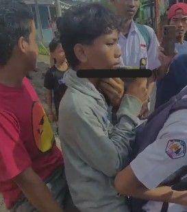 Korban bentrokan di Makassar terkena anak panah, Senin (21/5/2025)/Istimewa