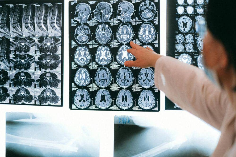 ilustrasi hasil CT scan (pexels.com/Anna Shvets)