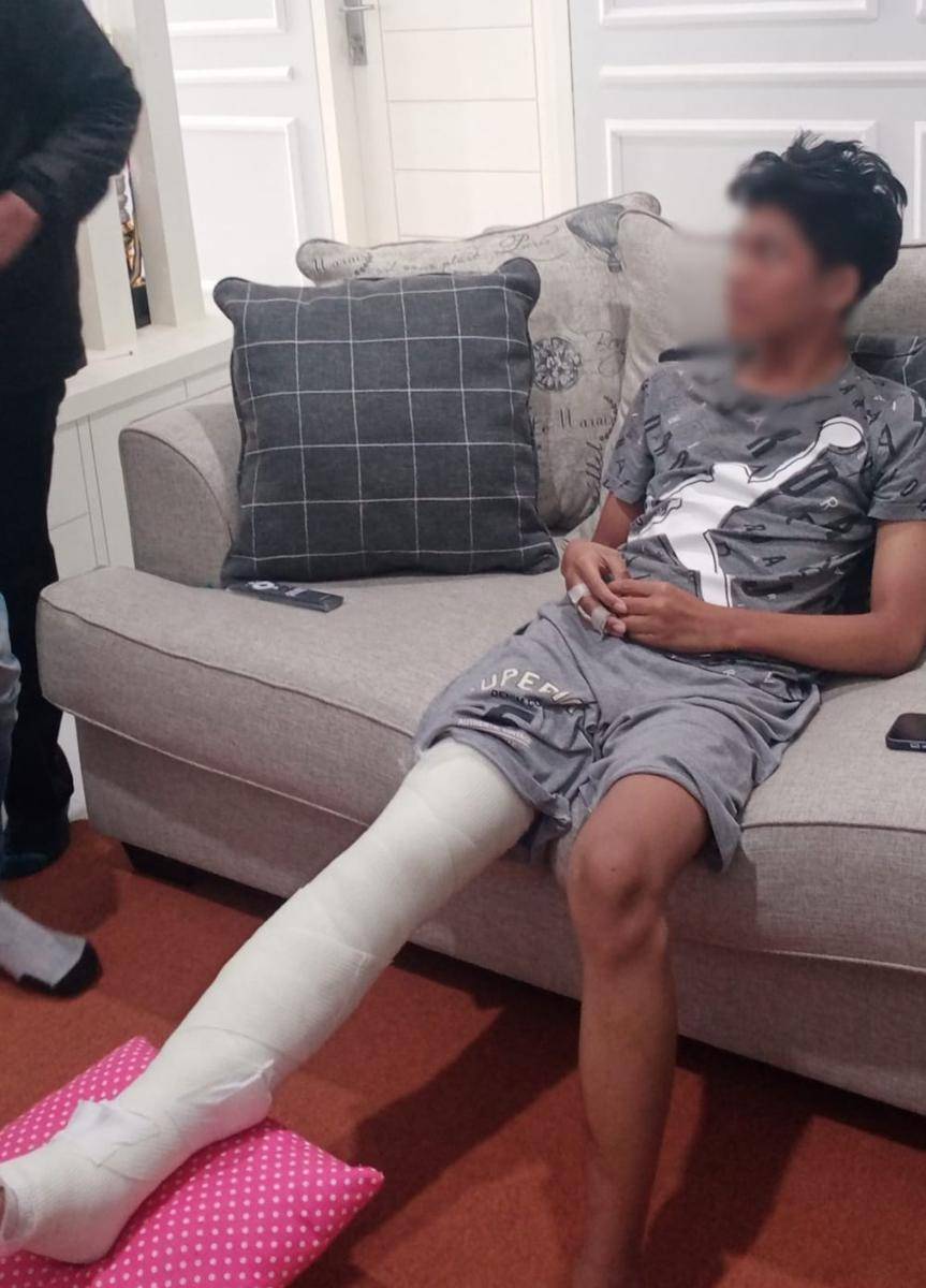 Kondisi RDP (korban kecelakaan wahana 360° Pendulum Jatim Park 1) usai menjalani operasi pada kaki dan tangannya. (IDN Times/Rizal Adhi Pratama)