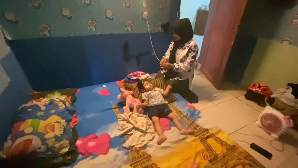 Balita Penderita Kelainan Usus Asal Lebak Butuh Bantuan