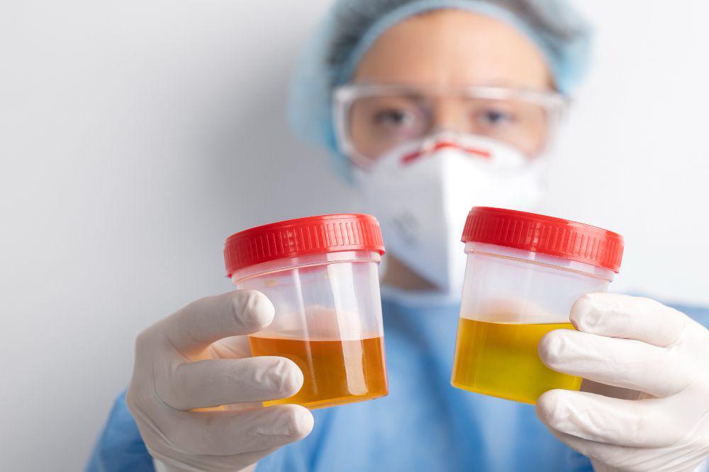 Enam Anggota Polres HST Terindikasi Narkoba usai Tes Urine Mendadak