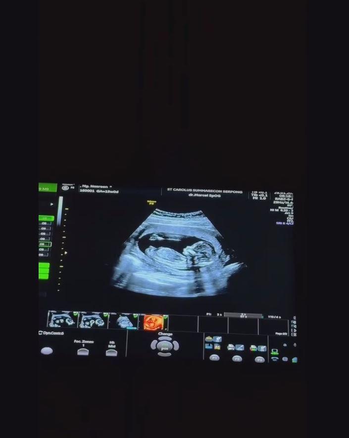 Nessie Judge umumkan kehamilan (Instagram.com/nessiejudge)