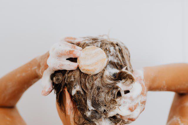 Apakah Sampo Non SLS Cocok untuk Penderita Dermatitis?