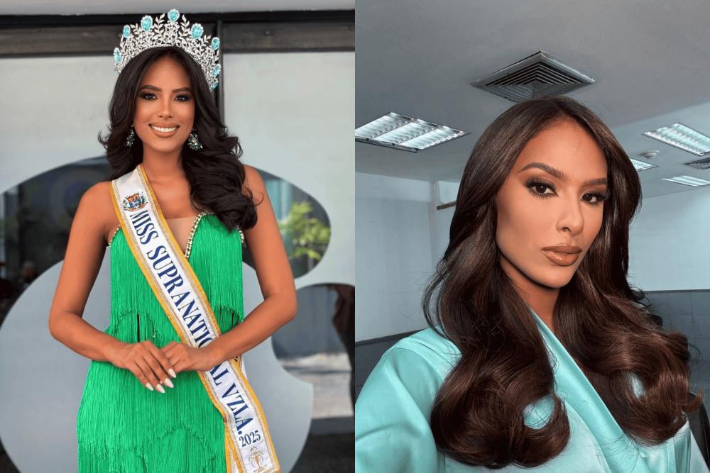 7 Potret Miss Supranational Venezuela 2025 Leix Collins, Standout!