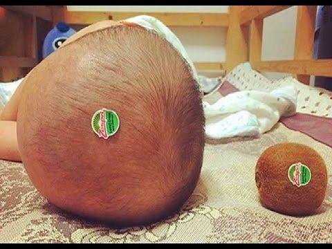 http://cdn.idntimes.com/content-images/community/2017/04/kepala-bayi-dan-kiwi-85b29f4ccfbe9eabfa942f781271fe8d.jpg