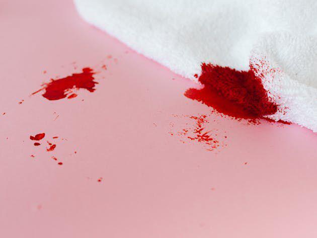 ilustrasi darah dalam urine (pexels.com/Photo By: Kaboompics.com)