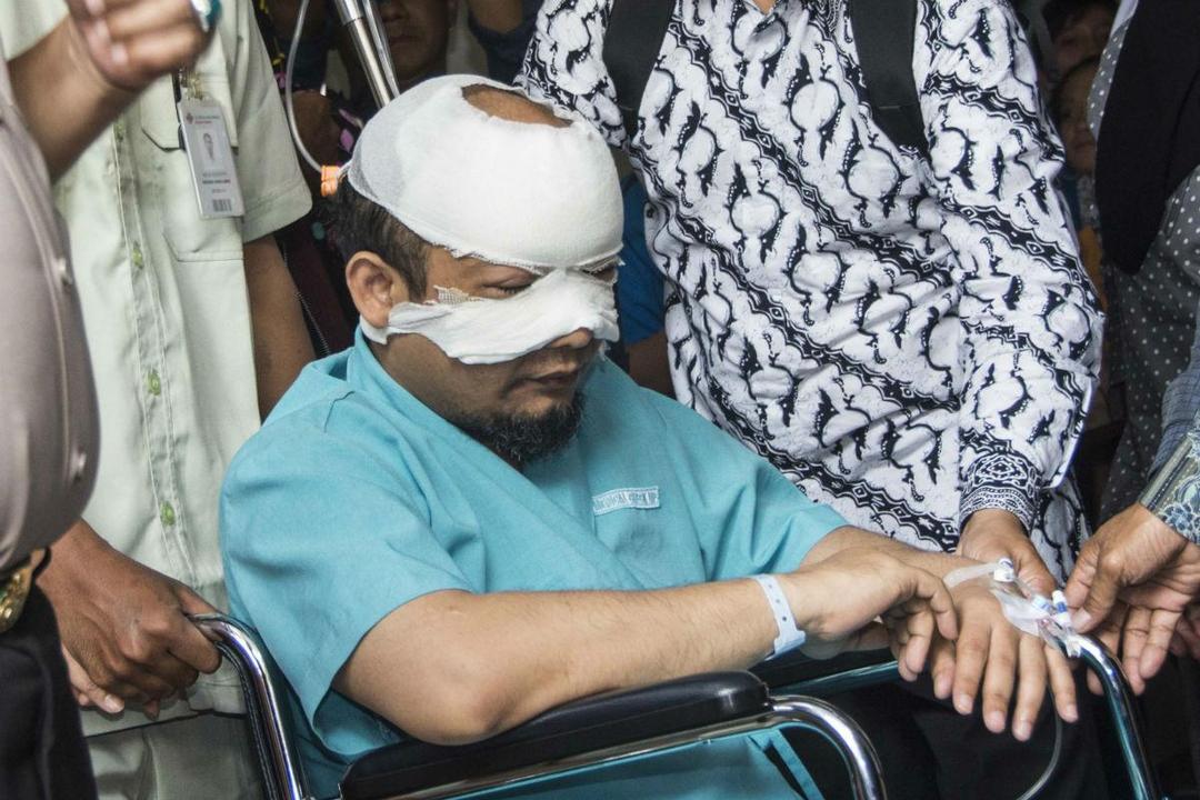 https://cdn.idntimes.com/content-images/post/20170418/antarafoto-novel-baswedan-dirujuk-110417-aaa-1-d078d5b398c7382e16f6036d393245f2.jpg