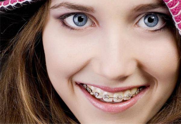 http://cdn.idntimes.com/content-images/post/20151031/ciptadentcoid.jpg