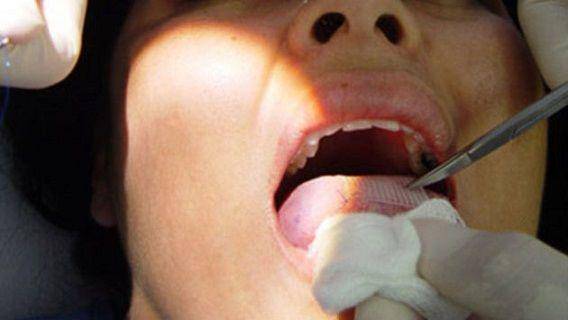 http://cdn.idntimes.com/content-images/post/20151003/diet2_tounge.jpg