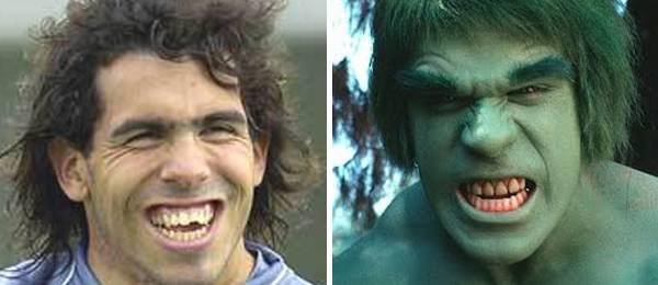 http://cdn.idntimes.com/content-images/post/old/e3525-Carlos-Hulk.jpg