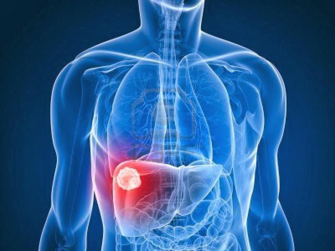 http://cdn.idntimes.com/content-images/post/20160718/liver-a0895869e0cbabbaea2bef6b490eb2d8.jpg