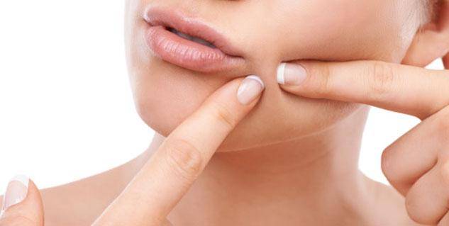 https://cdn.idntimes.com/content-images/post/20171130/popping-pimple633x319-4e74d2898109abdc2f52aea0812f4672.jpg