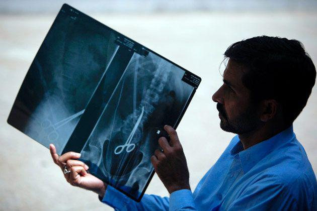 http://cdn.idntimes.com/content-images/post/20160806/x-ray-01-160412-630-jpg-051816-3c44f0c958e9b188be55080621777794.jpg