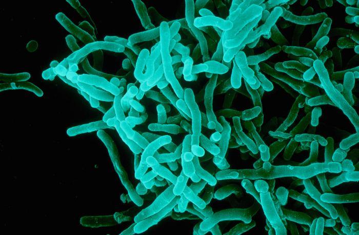 https://cdn.idntimes.com/content-images/post/20171208/diphtheria-sanofipasteur-993b915a017fd23aa25d703732bbb499.jpg