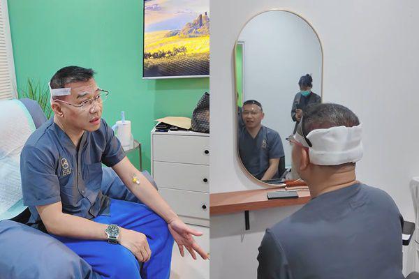 Potret Anang Hermansyah Transplantasi Rambut, Kepala Sampai Diperban