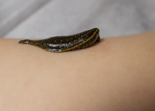 ilustrasi lintah (freepik.com/vershinin)